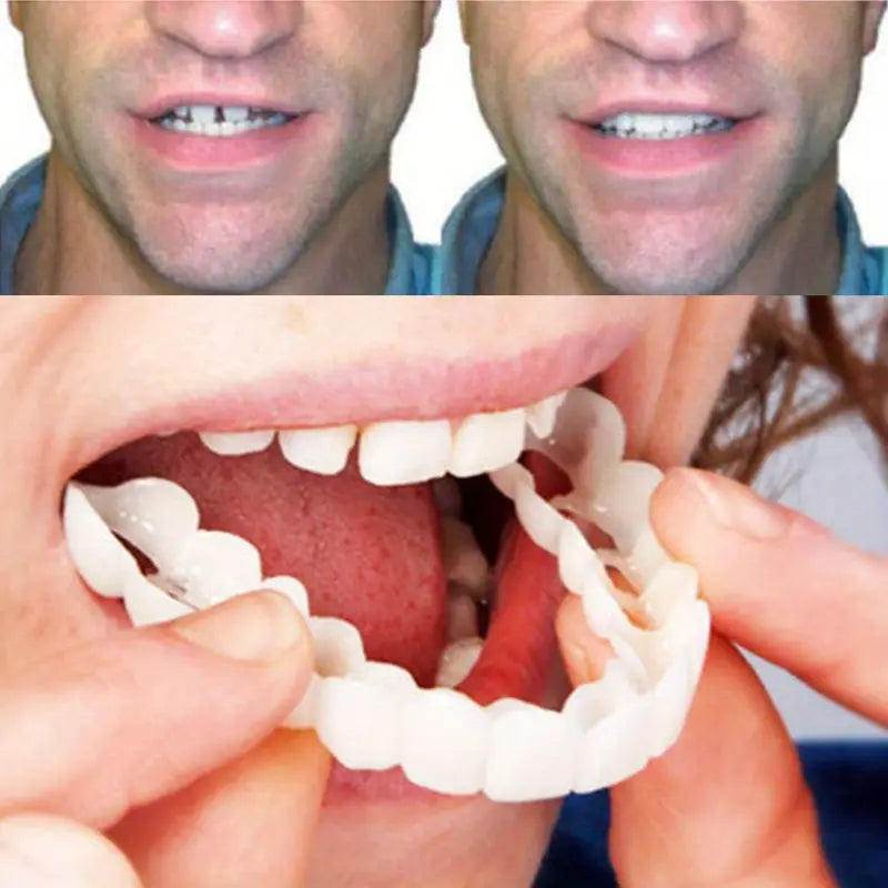 2 Pairs Realistic Dental Veneers – Upper & Lower Teeth, Natural Look & Whitening