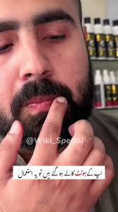 Wiki Special Lips Balm <Allow To Open>