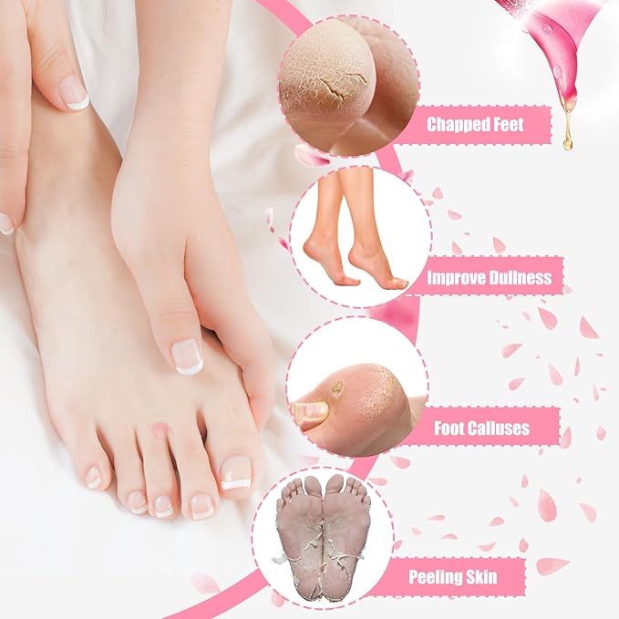 Moisturizing Socks - Silicone Socks for Dry Cracked Feet Women