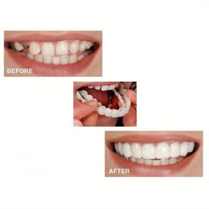 2 Pairs Realistic Dental Veneers – Upper & Lower Teeth, Natural Look & Whitening