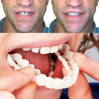 2 Pairs Realistic Dental Veneers – Upper & Lower Teeth, Natural Look & Whitening