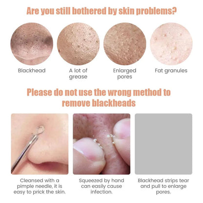 Electric Blackhead Remover, Vacuum Acne Cleaner, Black Spots Removal Device, Pore Cleaner Machine, Skin Care Tools, 5 Heads Suction Machine,  Vacuum Electric Black Head Extractions Tool, Electric Facial Pore Cleaner, Exfoliating Beauty Device